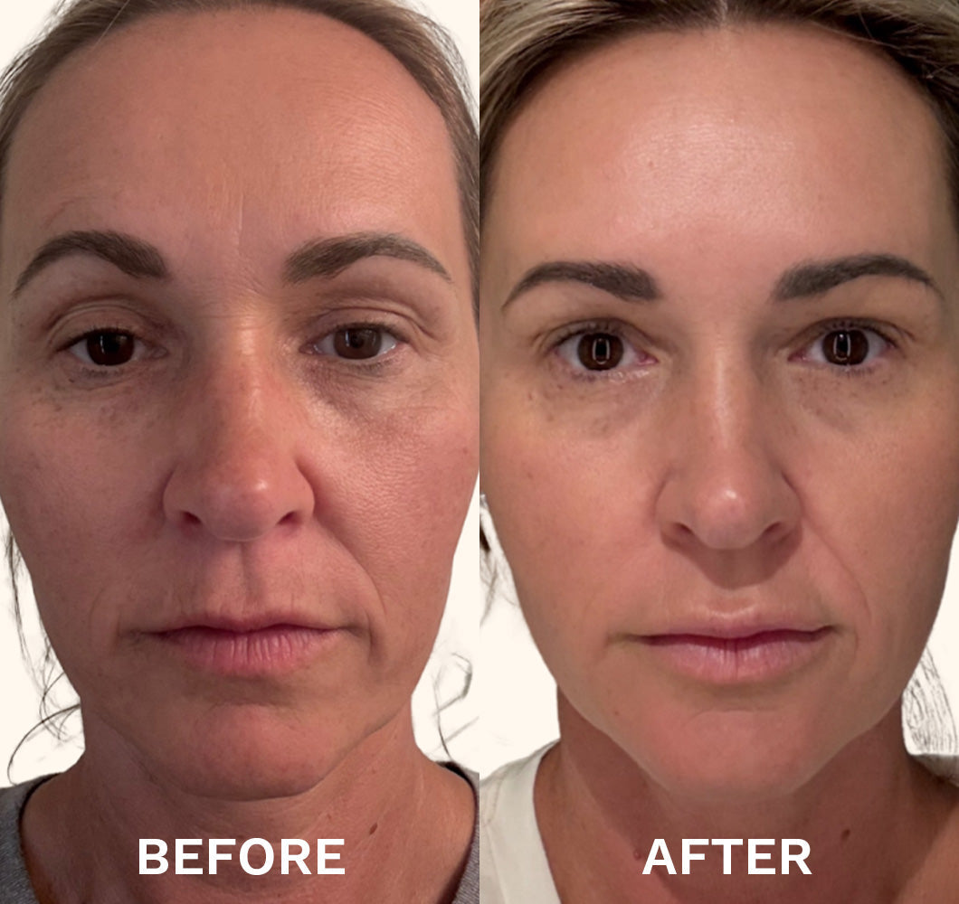 UltraClear Before and After