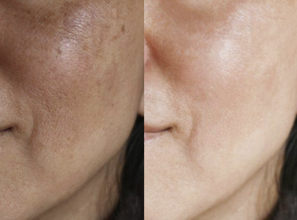 Hydration Skin
