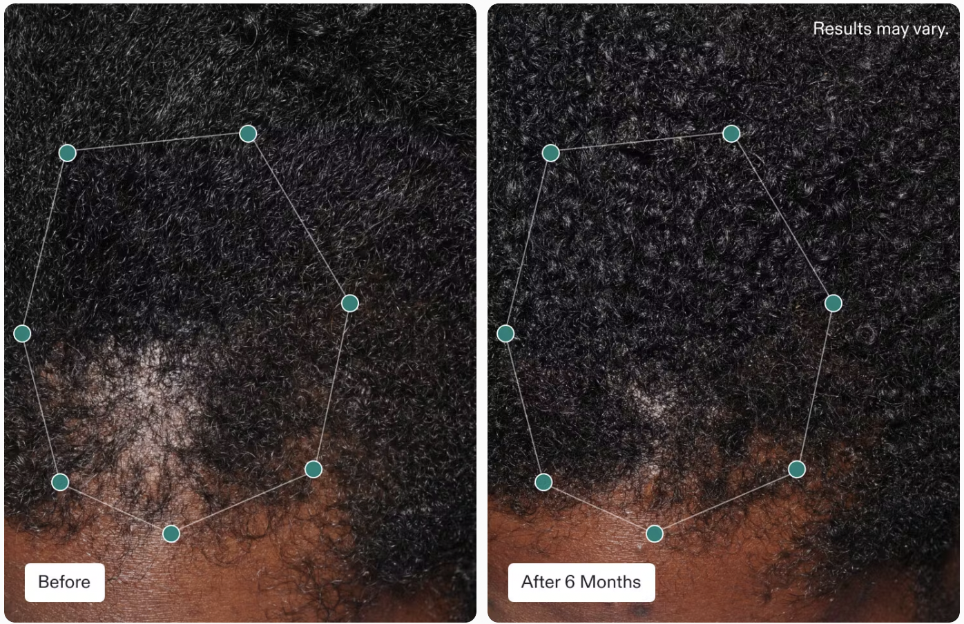 Nutrafol Women's Hair Growth